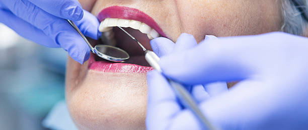 Best Emergency Dental Surgery in Montgomery Village, MD