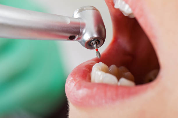 Best Pediatric Emergency Dentist in Montgomery Village, MD